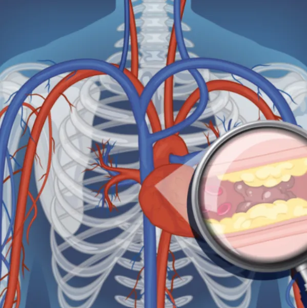 Aneurysms and Diseases of the Chest Understanding Causes Diagnosis and Treatment Options