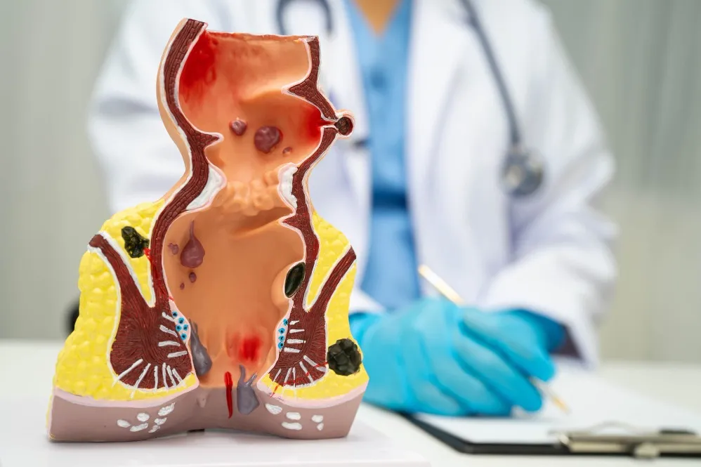 What Patients Should Compare Before Selecting Laser Treatment for Piles