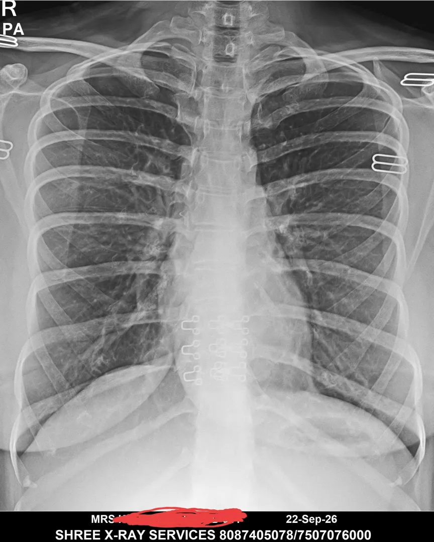 XRAY at Nigdi Pradhikaran