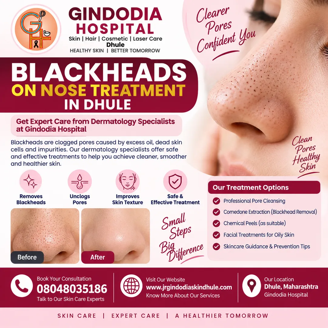 Blackheads on Nose Treatment in Dhule | Gindodia Hospital