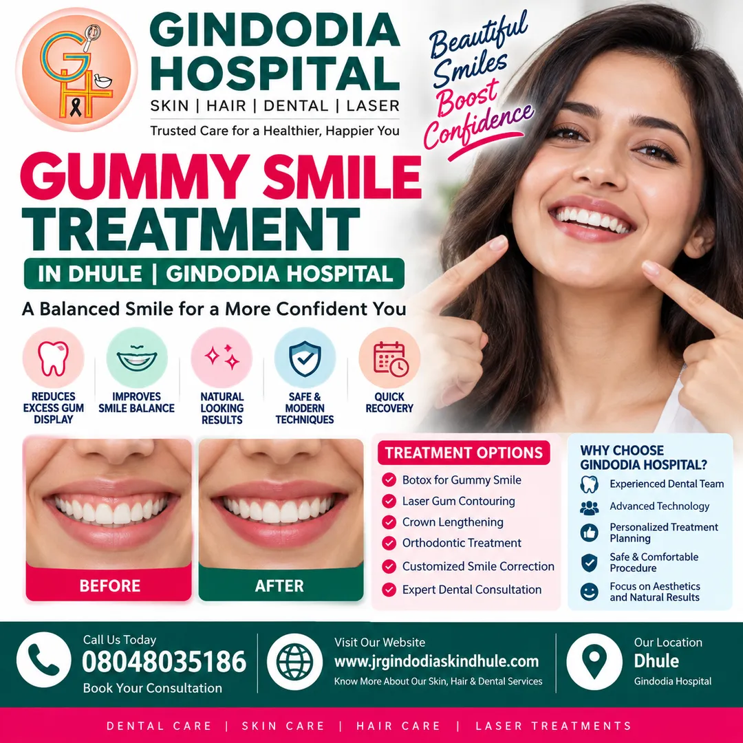 Gummy Smile Treatment in Dhule | Gindodia Hospital