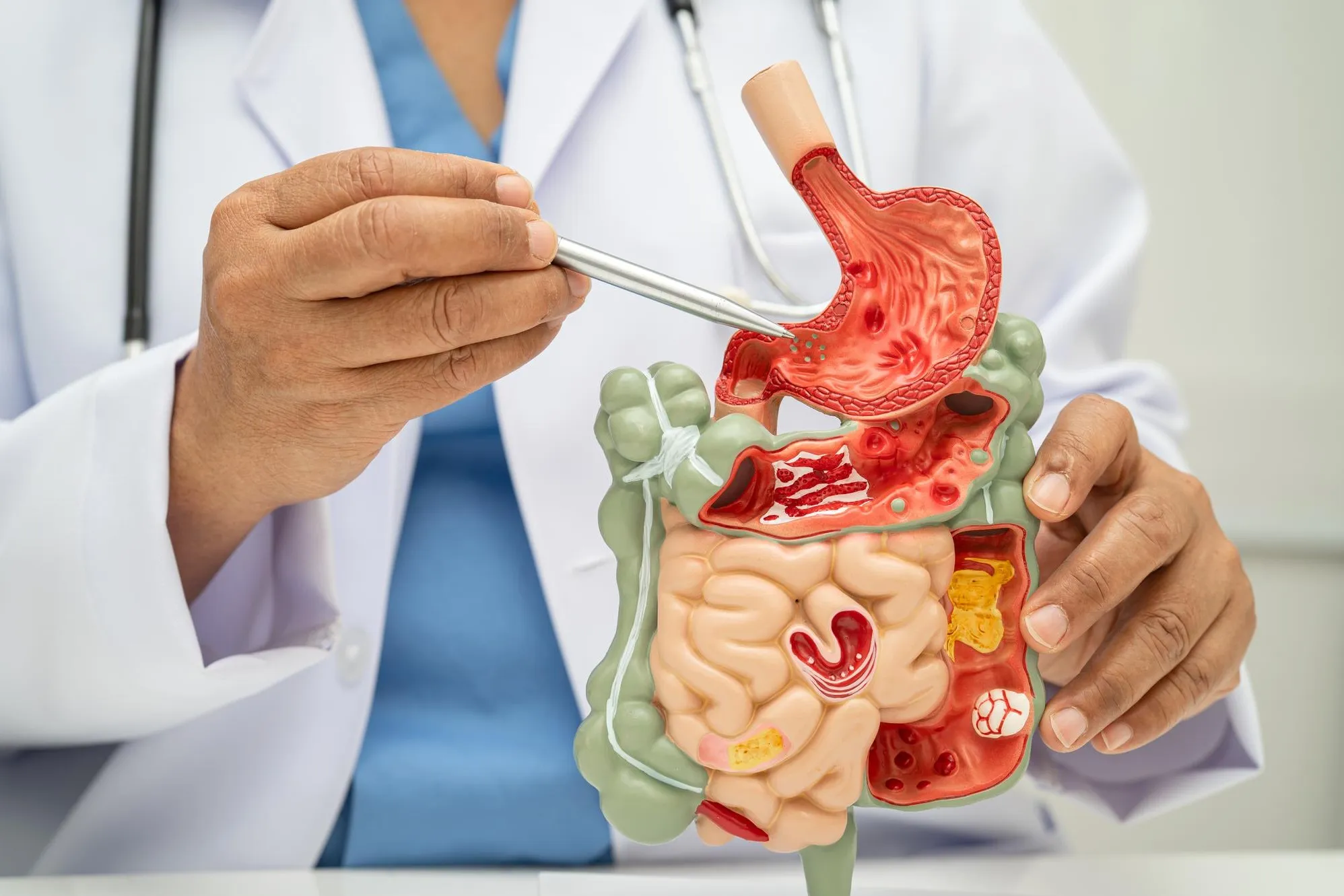 Gastrointestinal Disease Specialist in Thane for Persistent Digestive Symptoms