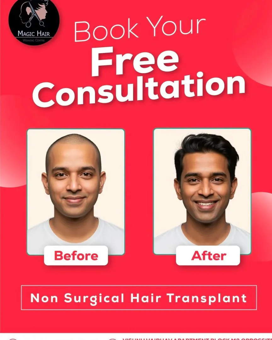Hair Loss Solution for Men Comparing Cosmetic Coverage Options for Thinning Hair