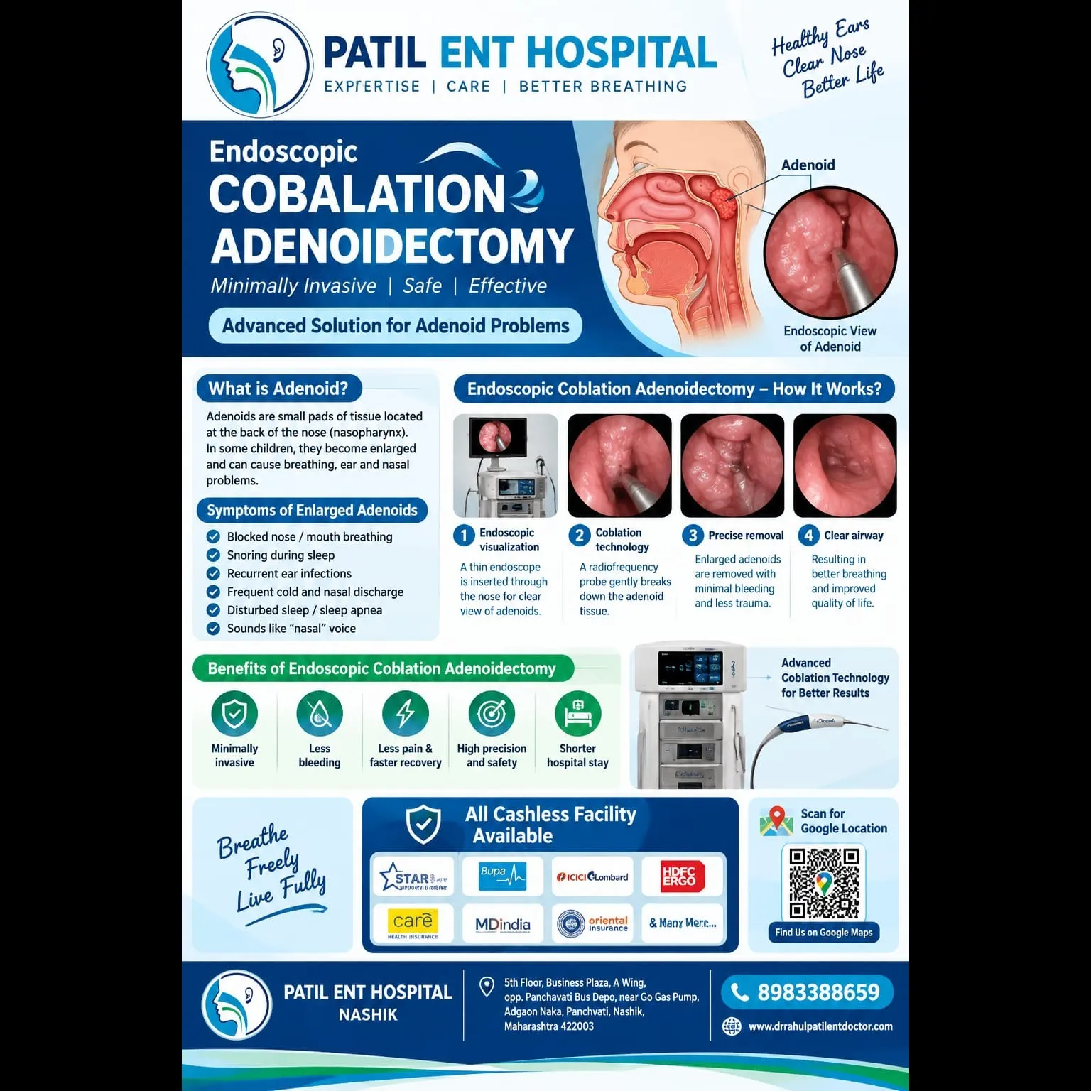 Coblation Adenoidectomy in Children – Advanced Treatment for Enlarged Adenoids | Patil ENT Hospital