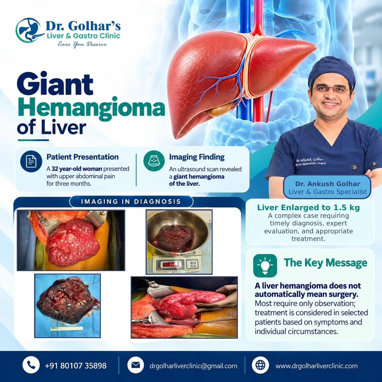 Giant Hemangioma of the Liver