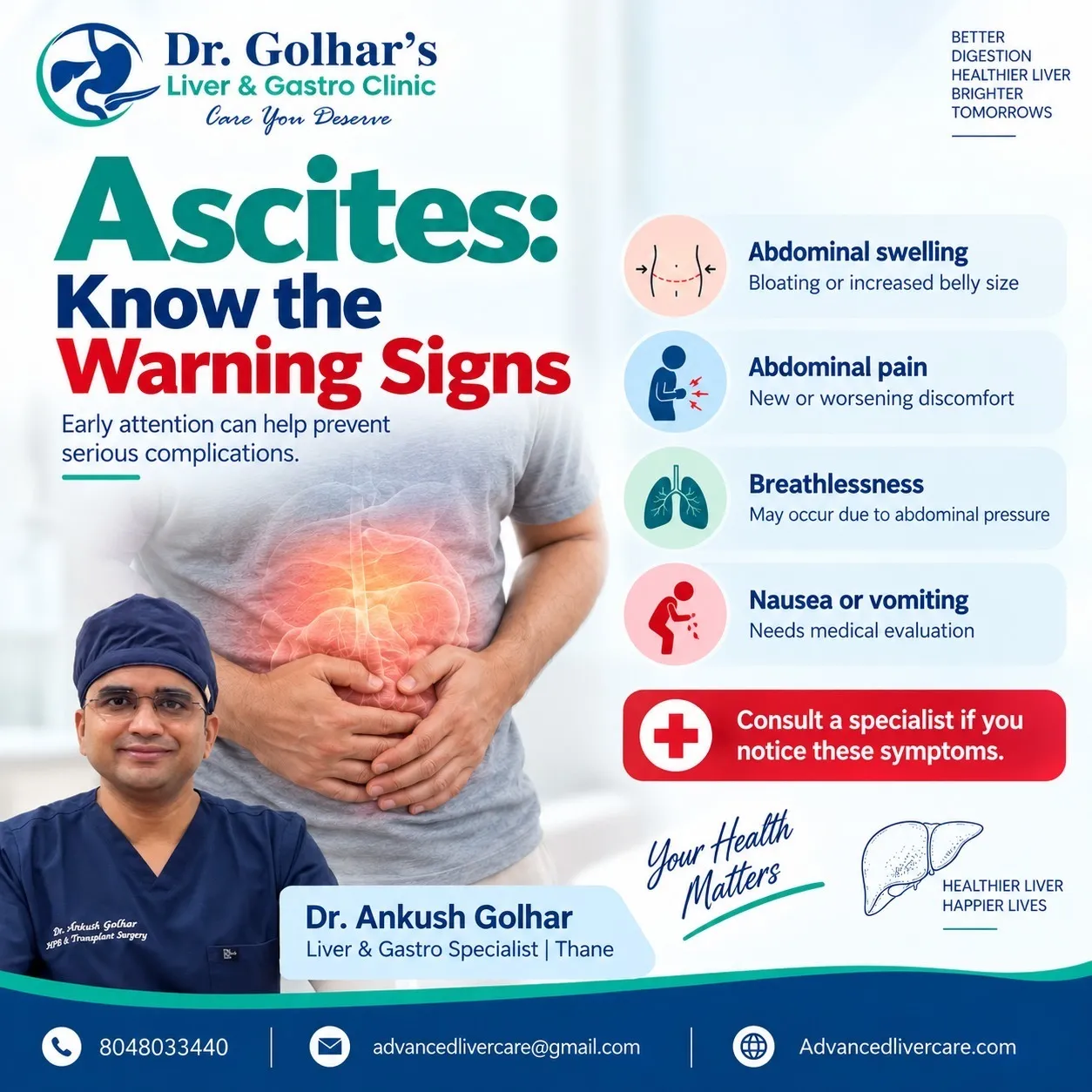 Ascites: Know the Warning Signs ⚠️