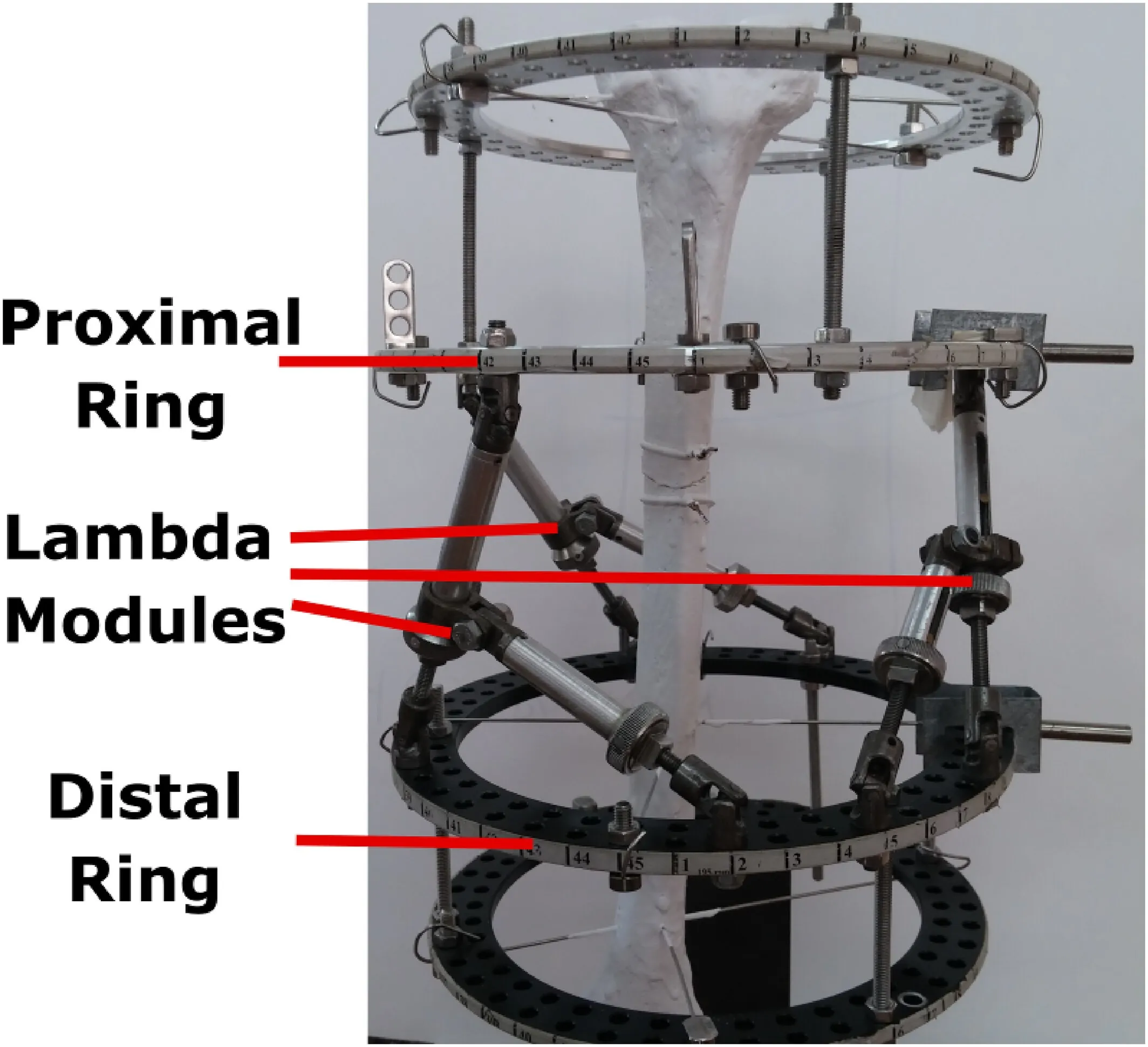 Ring Fixation System in Nagpur – Khurana Surgicals