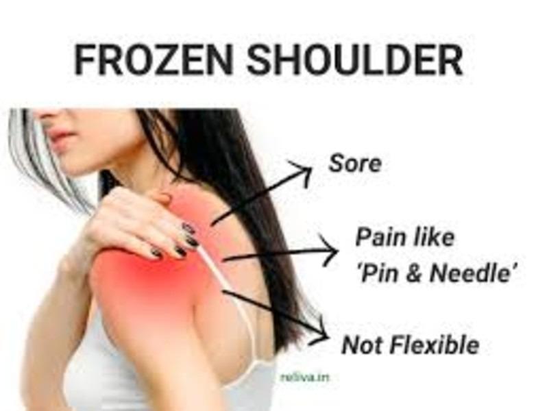 frozen shoulder rehabilitation