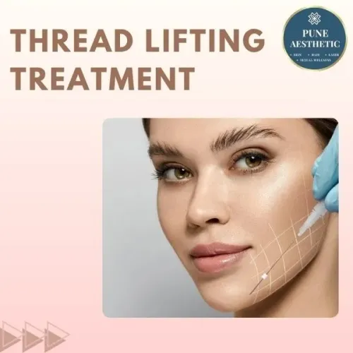 customized thread lifting trea