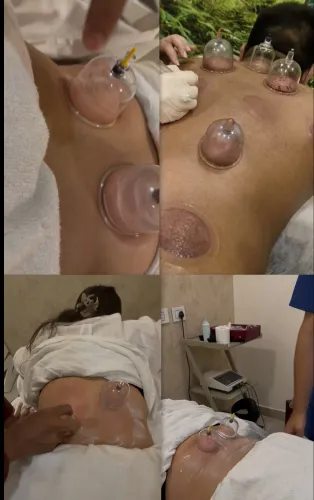 update image