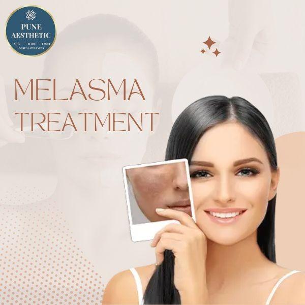 hyperpigmentation and melasma