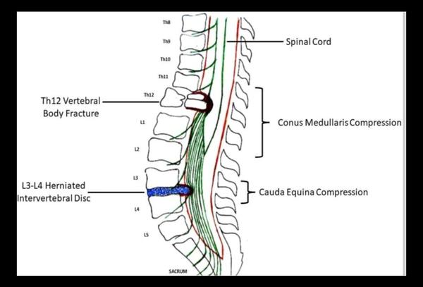 core stabilization exercises b