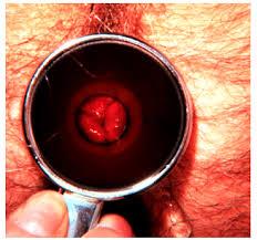 piles treatment in hindi
https://www.ayurvedapilescure.com/articles/piles-hemorrhoids/piles-ayurveda-cure-ghaziabad.php