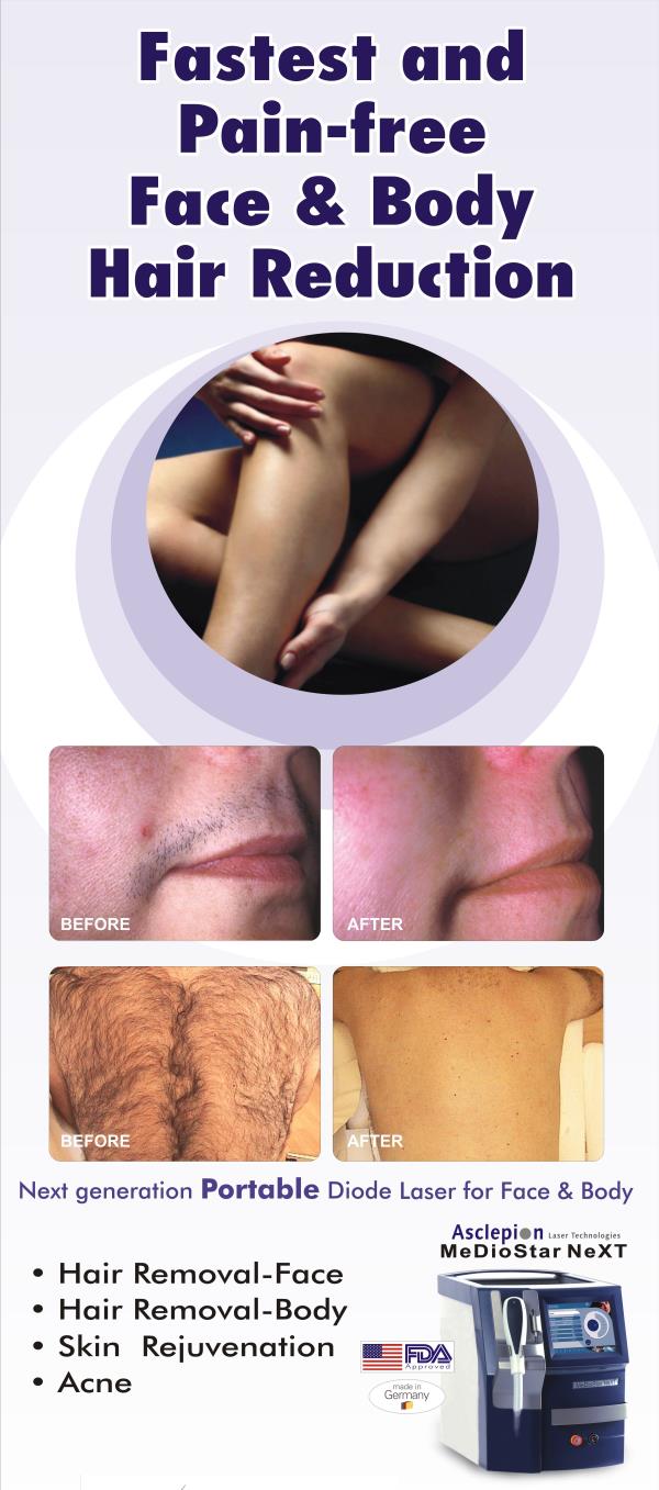 Laser hair removal is an increasingly popular non-surgical cosmetic procedure. It is a non-invasive, convenient method to reduce hair growth.