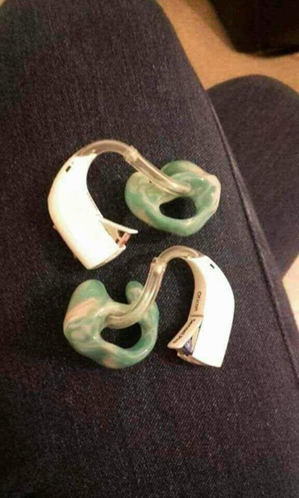 fitting bands
