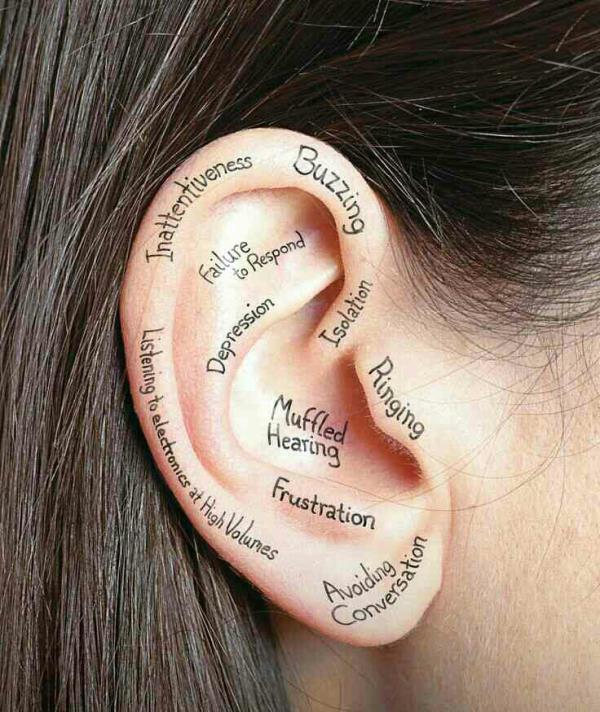 hearing loss treatment