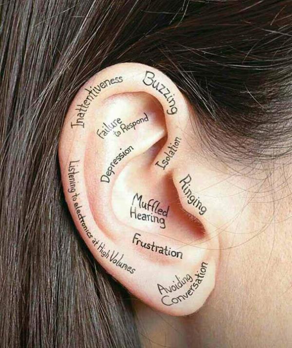 hearing loss treatment