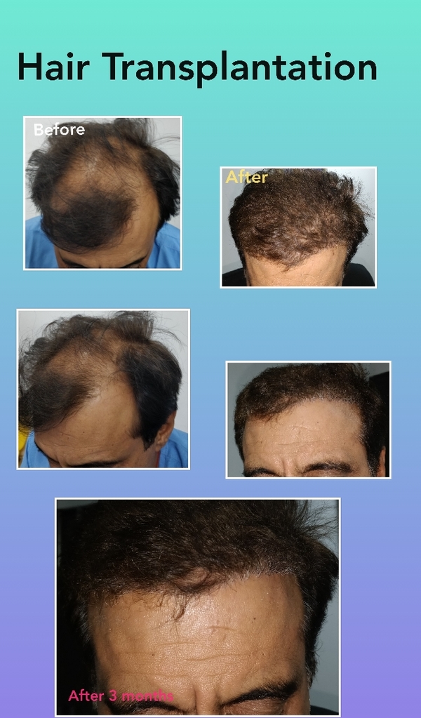 update image