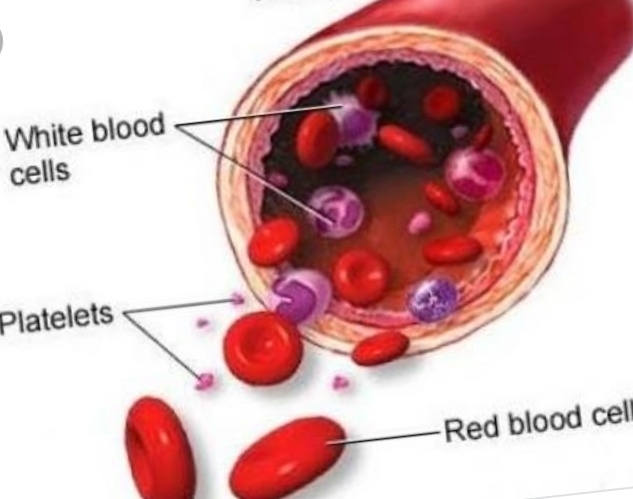 severe intestinal bleeding