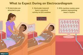 ecg records