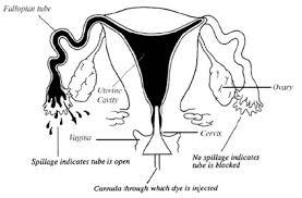 preliminary findings