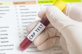 What is CRP test ????

C-react