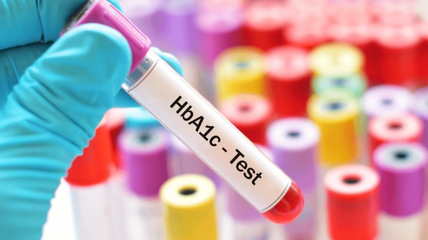 What is HbA1c test used for?

