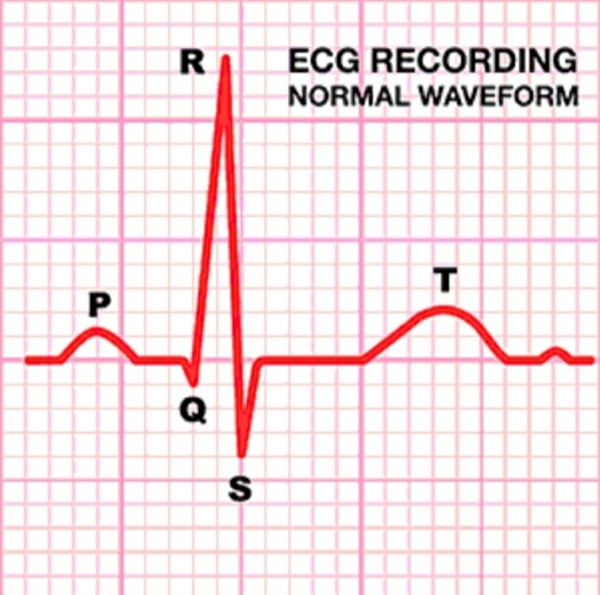 ECG ???
At www.diagnosticcentr