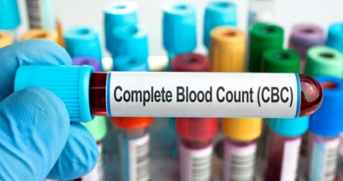CBC Test???
At www.diagnosticc