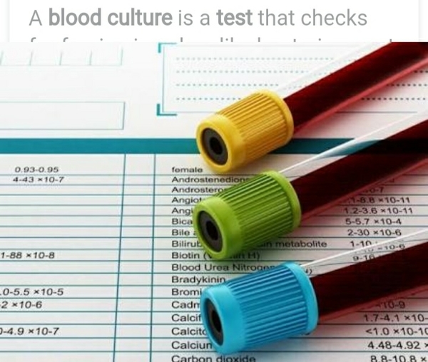 TYPHOID TEST OR WIDAL TEST ???