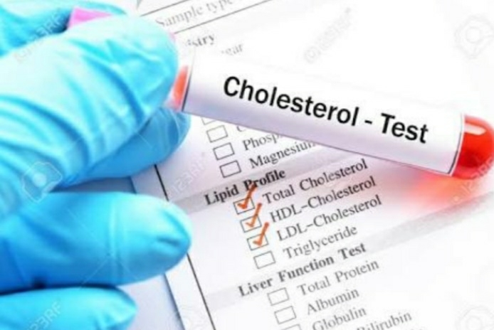 CHOLESTEROL TEST???
At www.dia