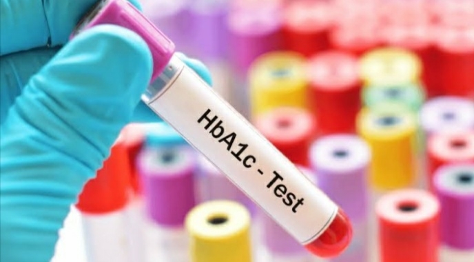 HbA1c Test ???
@www.diagnostic