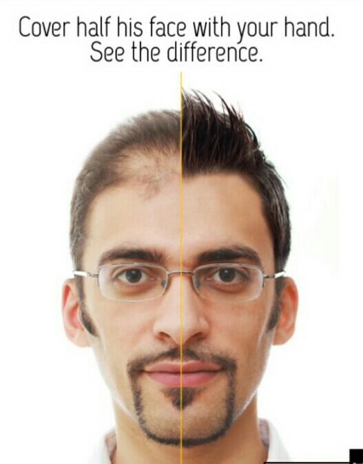 If u are loosing confidence cause of bal