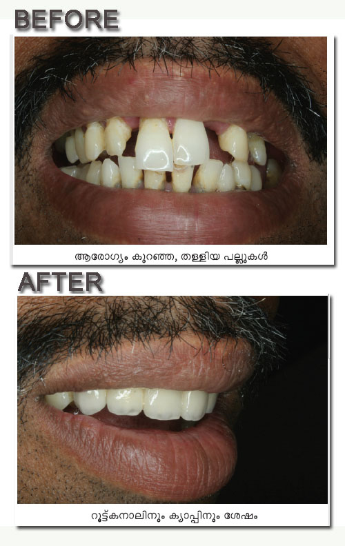 Emmanuel Cosmetic Dental Clinic in Ernakulam, India