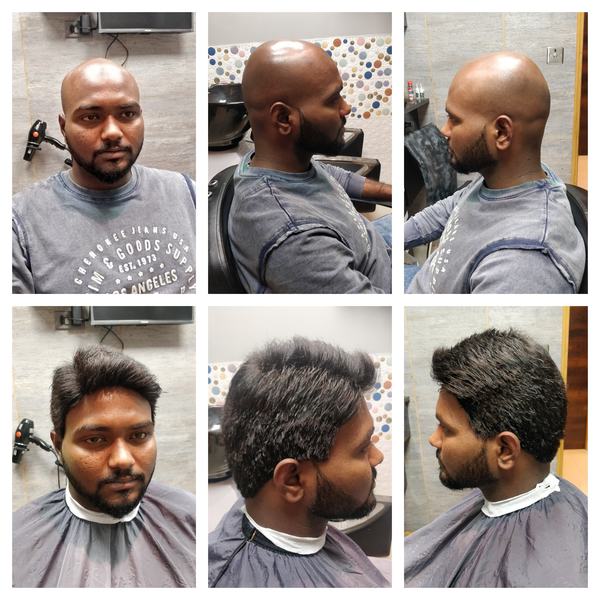 Hair Wigs in Sector 9a Gurgaon -
Lynx Ha