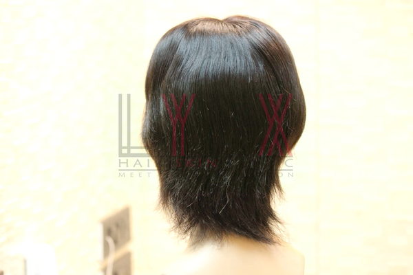 Hair Wigs in Sector 10a Gurgaon -

Lynx 