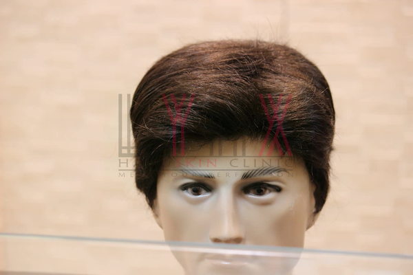 Hair Wigs in Sector 19 Gurgaon -

Lynx H