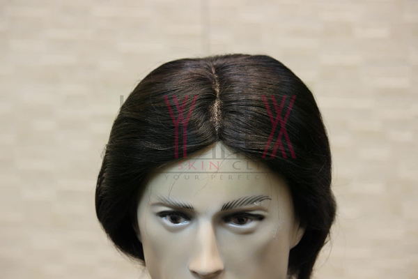 Hair Wigs in Sector 21 Gurgaon -

Lynx H