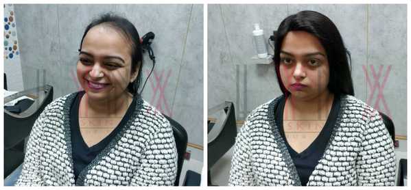 Hair Wigs in Sector 44 Gurgaon -

Lynx H