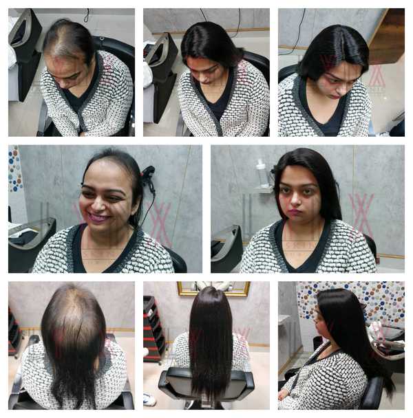 Hair Wigs in Sector 46 Gurgaon -

Lynx H