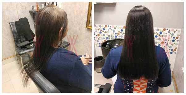 Hair Wigs in Sector 53 Gurgaon -

Lynx H