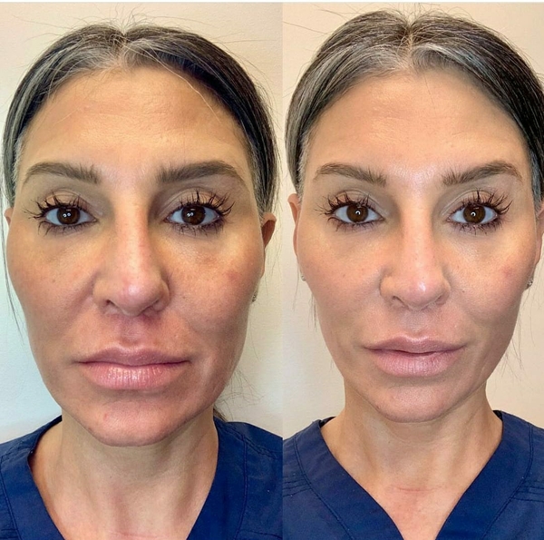 connective tissues