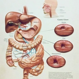 update image