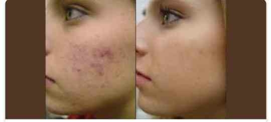 new collagen