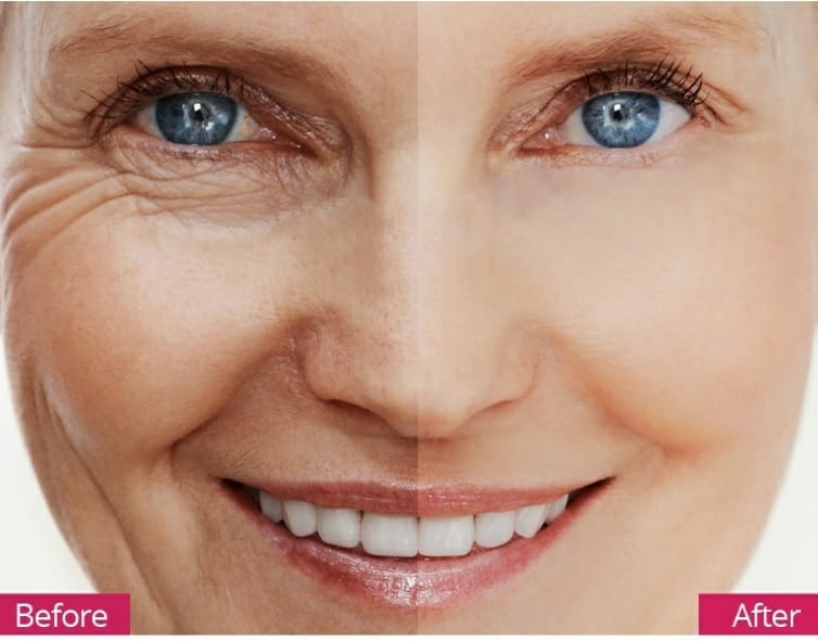 top rated anti ageing treatmen