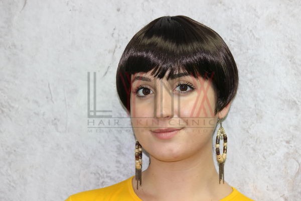 Hair Wigs in Bara Hindu Rao Delhi 

Lynx