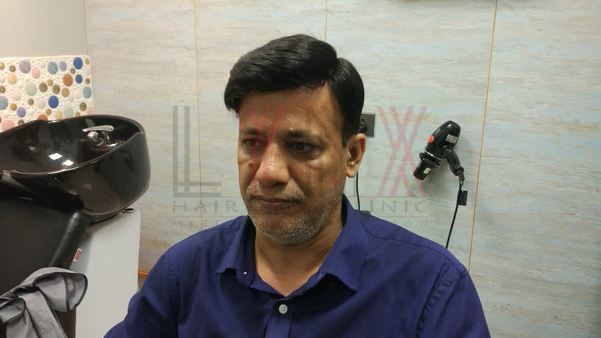 Hair Weaving in Rewari

Hair weaving in 