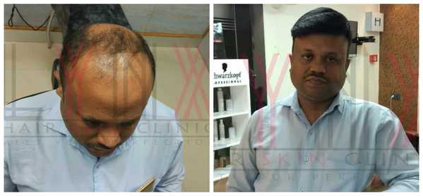 Hair Weaving in Bawadi

Hair weaving in 