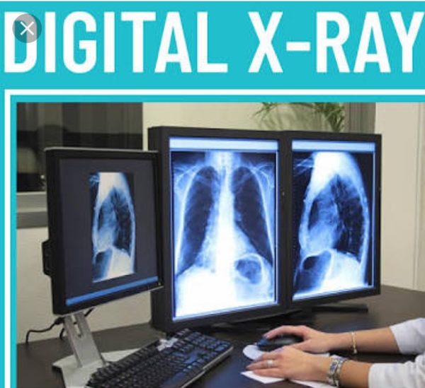 Digital X-Ray.
@ diagnost