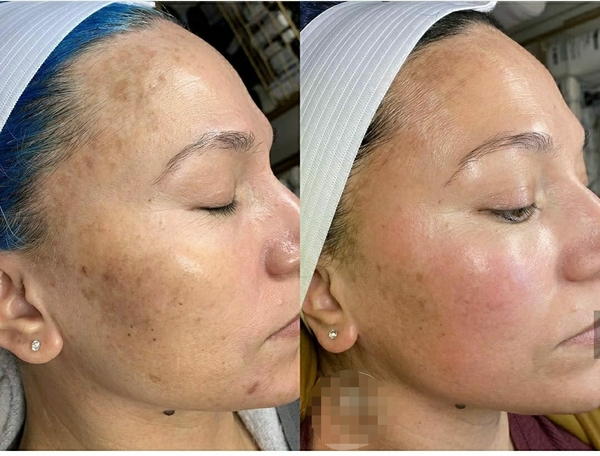 frequent waxing